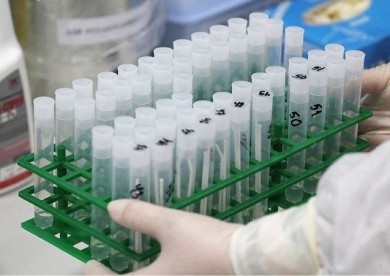 «Очень многое сейчас зависит от общества» — белорусские эпидемиологи о борьбе с коронавирусом