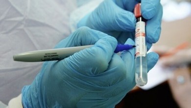 21 случай коронавируса в Могилевской области зарегистрирован на 7 апреля