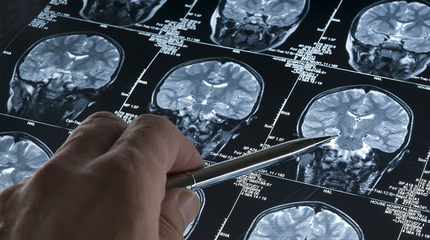 Китайские ученые выяснили, как мозг переключается между воспоминаниями и восприятием реальности